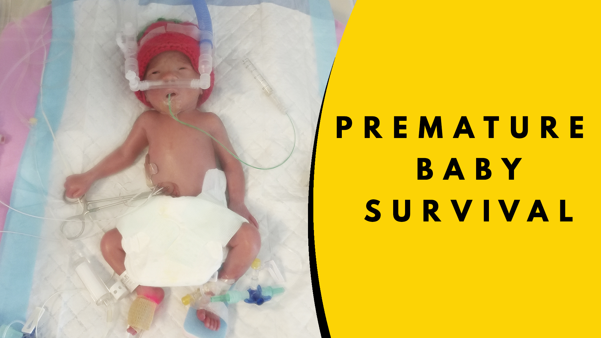 can a 6 month old premature baby survive